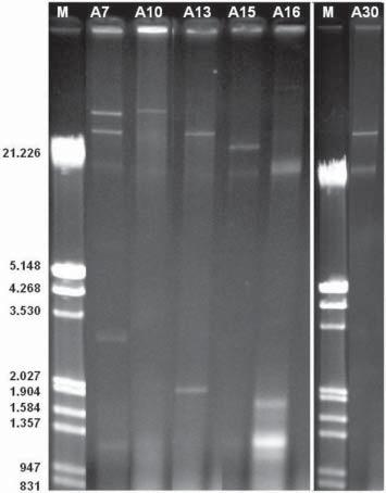 Gıda Kökenli Salmonella enterica Suşlarının Patojenik Fenotiplerinin ve Virülans Determinantlarının Caenorhabditis elegans Hayvan Modelinde İncelenmesi bulunmuştur.