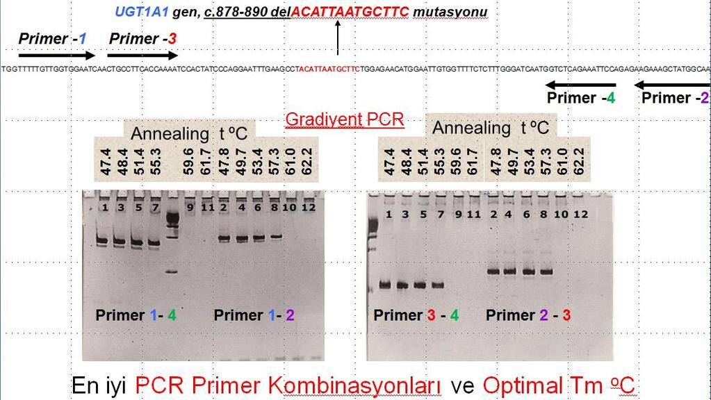 PGT Protokol Hazırlanması 2q37 bölgesi Genomik Organizasyonu (Crigler-Najjar Sendromu, UGT1A1 loküsü) c.