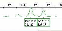 Aile Bireylerinde Haplotipleme Yapılması Kan Örneği DNA eldesi Floresan PCR Paternal Haplotip 134 140 113 101 174 176 DEL WT 196 208 112 116 Maternal Haplotip 111 134 115 113 174 174 WT DEL 184 196