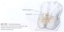 Beyinde kan beyin bariyeri bulunmayan yapılar: Circumventricular organlar (gl.