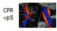 Yönetim EFW< 3 pers 38 GH İndüksiyon FGK (EFW veya AC<%10) Doppler Sorun var (CPR<5 pers, UA PI>95 pers, UtAPI>95 pers) >37 GH İndüksiyon Doppler Sorun Yok Bireyselleşmiş