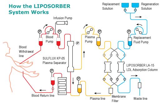 Dekstran Sülfat (Liposorber LA-15) Bu sistem ligand olarak dekstran