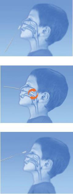 Ellerinizi yıkayın. Maske giyilir. Hasta yüzü ışığa dönük olacak şekilde oturtulur. Jelsiz swap kullanılarak her iki burun ve nazofarenks mukoza yüzeyine sürülerek alınır.