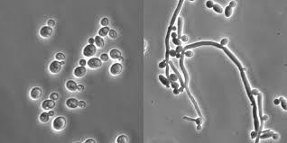 IFI ye neden olabilecek mantarlar: Aspergillus türleri Candida türleri Candida