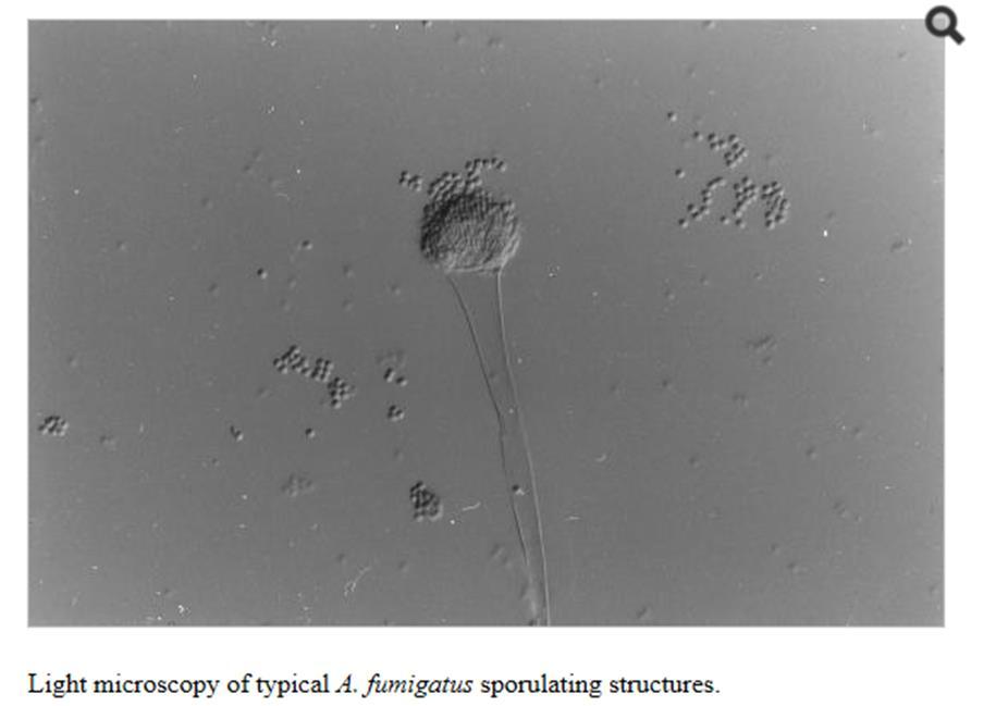 Aspergillus, hif olarak adlandırılan hücre zincirlerinden oluşan ipliksi yapıda