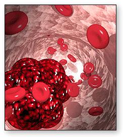Hemostaz kanın vasküler sistemde sıvı fazda kalmasını idame ettirirken, hasarlı kan damarlarının duvarlarında pıhtı oluşturarak kan