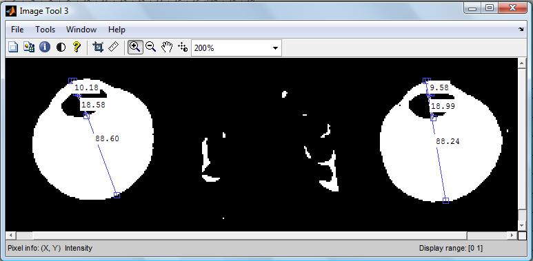 Görüntü işlemenin ardından görüntü analizine uygun hale getirilen MR görüntüleri üzerinde imtool penceresi yardımıyla ilgili hesaplamalar yapılmıştır (Şekil 2.6). Şekil 2.
