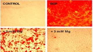 Diyalizat magnezyum Magnezyumun bazı olumlu etkileri olduğu düşünülmekte PTH baskılama, atheroskleroz-tromboz-aritmi önleyicilik, vasküler kalsifikasyonu engelleme, sol ventrikül hipertrofisi üzerine