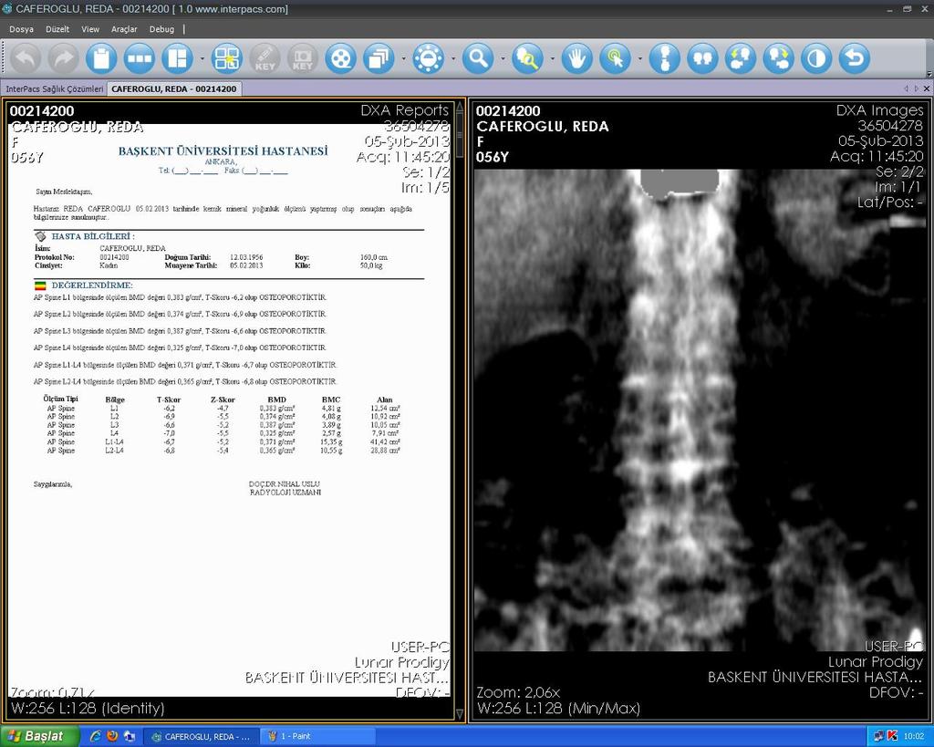 (02/2013) KMD: L1-4