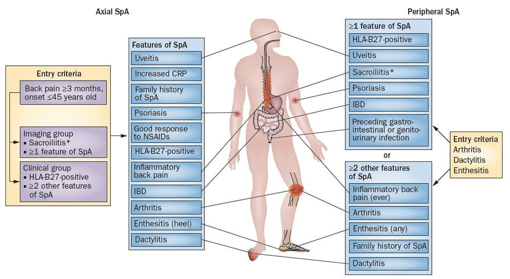ASAS aksiyal ve periferik SpA sınıflandırma kriterleri Rudwalet