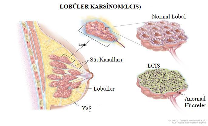 2. MEME YAPISI VE MEME KANSERİ Meme Anatomisi ve