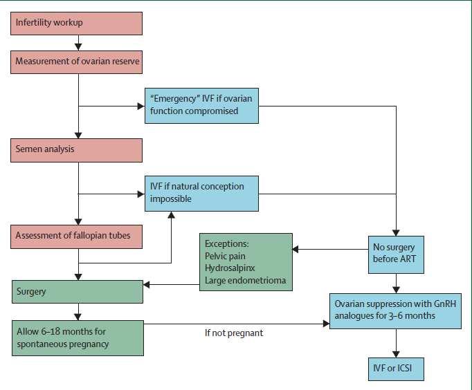 Endometriosise bağlı infertilitede