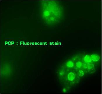 PCP-TANISAL YAKLAŞIM Direkt floresans