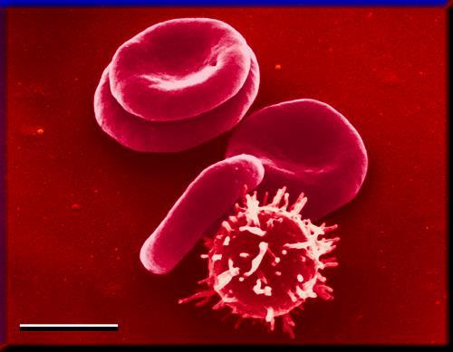 Transfüzyon öncesi immünohematolojik uyum testleri Prof. Dr.