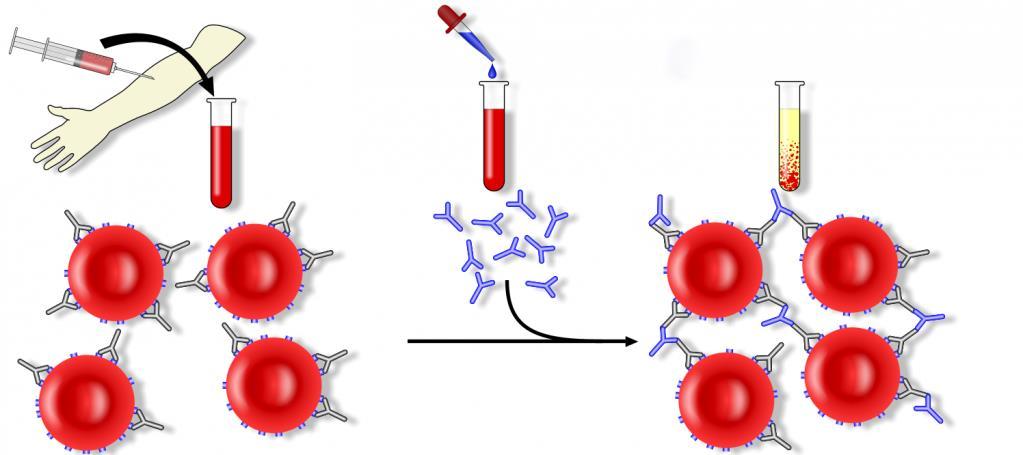 DİREKT ANTİGLOBULİN TEST (DAT) İmmun hemolitik transfüzyon reaksiyonu Donör eritrositleri Alıcı antikorları Yenidoğanın hemolitik hastalığı Fetal