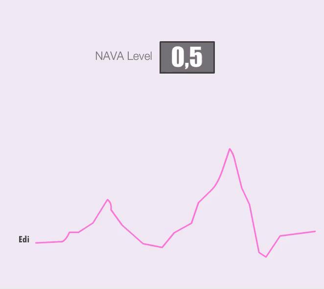 Başlangıç NAVA Düzeyinin Ayarlanması Birinci Seçenek İnvaziv NAVA da1.0, NIV NAVA da 0.5 ayarla. Stabilizasyon için bekle.