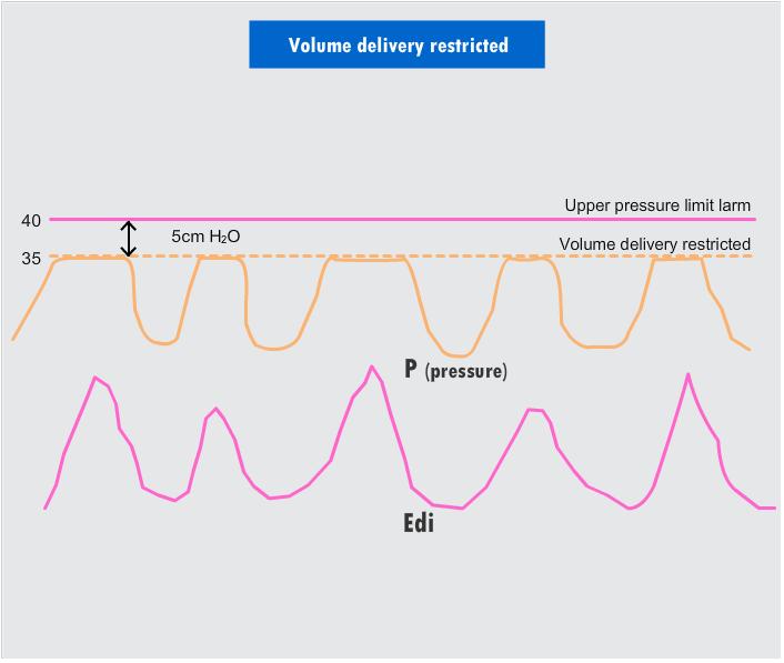 Alarm Limitlerinin Ayarlanması Üst