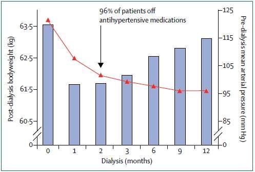 Uzun Hemodiyalizde Volüm Kontrol Stratejisi Tassin Deneyimi 876 insident HD hastası, HD e başlarken %90 ında AKB yüksek 1. ay: post-hd vücut ağırlığı (VA) 2-3 kg azaltılıyor 2.