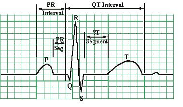 ekil 6. Normal elektrokardiyogram bile i i P DALGASI Atriyumların depolarizasyonu ile olu an dalgadır. Yenido an dönemi dı ında çocuklarda P amplitüdü < 2.5 mm dir.
