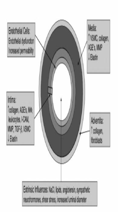 Arteryel sertlik Yaşla duvar kalınlaşması ve dilatasyon Tunica media ve