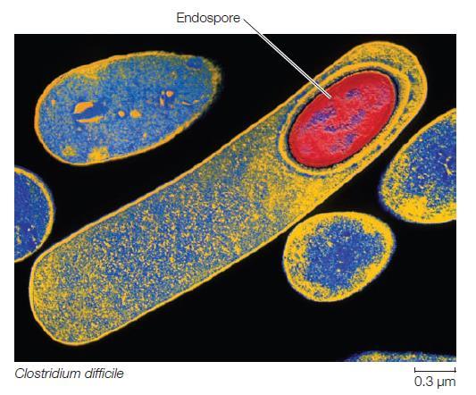 Clostridium difficile: insanlarda kolite