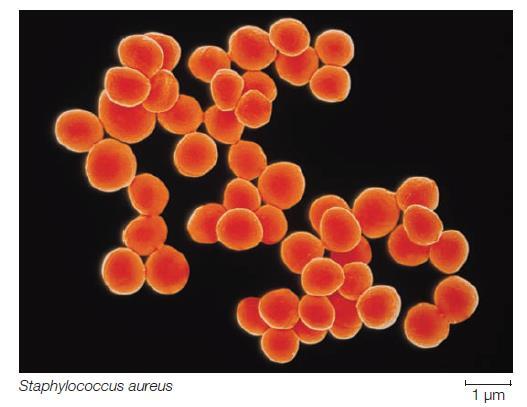 Staphyloccus aureus: insanların %20-40