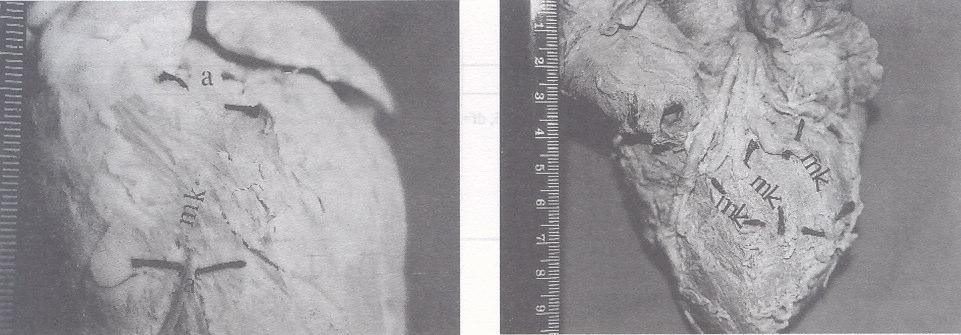 Köpek kalbi üzerinde çounluu ön yüzde olan toplam 9 adet MK (köprülerin altından siyah ipek iplik geçirilmi durumda) r.interventricularis anterior ve bunun 1. ve 2.