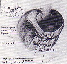 posterior fasyanın vajinal apeks düzeyinde devam etmesi Anterior endopelvik fasyanın