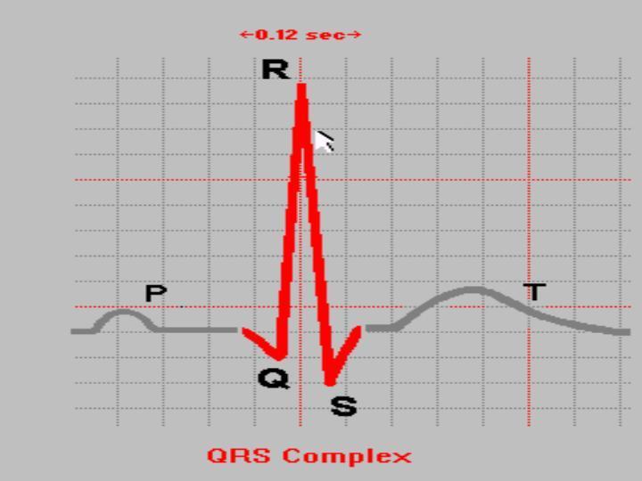 QRS kompleksi Ventrikül