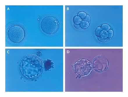 Embryos and Blastocysts during Assisted Reproduction
