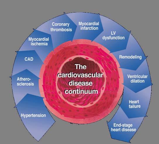 RAS Blokerleri İle Yapılan Çalışmalar ACE inhibitörleri ARB