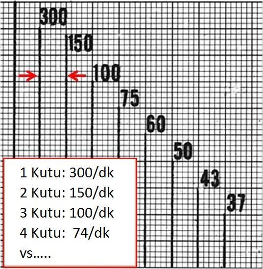 küçük kare sayısı Ritim düzensiz ise: 15 tane