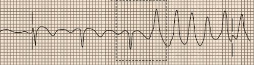 Anterior  Pozitif