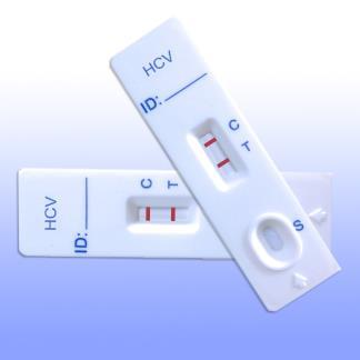 Klinik Mikrobiyoloji Laboratuvarında AntimikrobiyalYönetim-Başarılabilir Eylemler Antibiyotik duyarlılık test sonuçlarına tedaviye yol gösterici yorumlar eklenmesi Biyobelirteçlerin kullanımı için