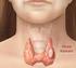 Tiroid Cerrahisinin Laringeal Komplikasyonları