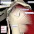 Tekrarlayan anterior omuz instabilitelerinde artroskopik tamir ilkeleri* (Absorbe olan çiviler ile tamirde ilk klinik sonuçlarımız)