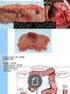 Role of RDW and MPV in Diagnosis of Colorectal Polyps and Carcinoma: A Case-Control Study