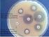 Determination of Antibiotic Susceptibility of Escherichia Coli Bacteria with Image Processing Techniques