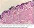 Seromüköz bez yapıları içeren bir Tailgut kisti: Olgu sunumu TAILGUT CYST WITH SEROMUCOUS GLANDULAR STRUCTURES: CASE REPORT