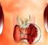 Romatizmal hastal klarda tiroid fonksiyonlar