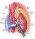 ADRENAL İNSİDENTALOMALAR