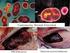 Enterokoklar ve Enterokoklarla Gelisen Infeksiyonlar. Enterococci and Infections caused by Enterococci