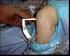 Patellar tendon ile artroskopik ön çapraz bağ tamiri Mehmet S. Binnet, Mehmet Demirtaş