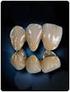 METAL DESTEKLİ DENTAL PORSELENLER