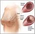 VERİ MADENCİLİĞİ YÖNTEMLERİ İLE DIABETES MELLITIUS HASTALIĞINA SEBEP OLAN FAKTÖRLERİN TESPİTİ