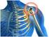 Rotator manşon tendinopatisine bağlı hemiplejik omuz ağrısında proloterapinin etkinliği: pilot çalışma