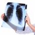 Akciğer Kanserli Hastalarda Yaşamın Sonu