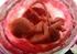 Doğumöncesi tanı ya da prenatal tanı, embriyonik ve fetal tanının tüm yönlerini içermektedir.