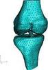 HUMAN FEMUR MODELLING and LOAD DISTRUBUTION ANALYSIS