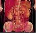 Superior Mezenterik Arter Sendromunda Radyolojik Bulgular